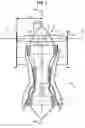 Fig. 02 - Low-pitch variable-setting fan of a turbine engine