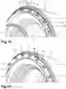 Fig. 08 - Aircraft turbine engine with reduction gear