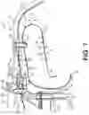 Fig. 07 - System and method for cleaning cooling passages of a combustion chamber
