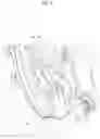 Fig. 05 - Brake dust cover
