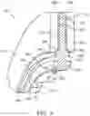 Fig. 04 - FRICTION DISCS WITH ANGLED STATOR LUGS