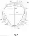 Fig. 04 - SEAL MEMBER AND FIXING MEMBER FOR THE SAME