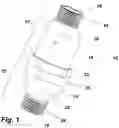 Fig. 02 - Check valve for use with super absorbent polymer