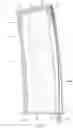 Fig. 02 - Quick loading ammunition magazine