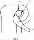 Fig. 06 - Trigger device