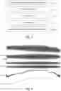 Fig. 05 - OCT system calibration method for improved image resolution and reduced image artifacts