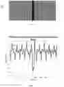 Fig. 08 - Test of operational status of a digital scanner during lithographic exposure process