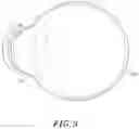 Fig. 04 - INSPECTION METHOD FOR THE POSITIONING POINT OF A CONTACT LENS