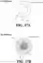 Fig. 19 - SAMPLE TRANSFER DEVICE