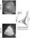 Fig. 09 - Time-resolved laser-induced fluorescence spectroscopy systems and uses thereof