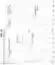 Fig. 13 - Blood condition analyzing device, blood condition analyzing system, and blood condition analyzing program