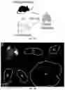 Fig. 11 - Lung protease nanosensors and uses thereof