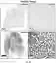 Fig. 13 - Lung protease nanosensors and uses thereof