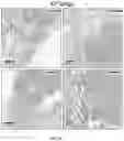 Fig. 14 - Lung protease nanosensors and uses thereof