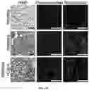Fig. 28 - Lung protease nanosensors and uses thereof