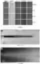 Fig. 37 - Lung protease nanosensors and uses thereof