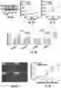 Fig. 04 - Nanoplasmonic quantification of tumor-derived extracellular vesicles in plasma microsamples for detection and treatment monitoring