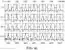 Fig. 26 - Broadband achromatic flat optical components by dispersion-engineered dielectric metasurfaces