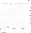 Fig. 01 - METHOD OF FLUID DROPLET OFFSET AND APPARATUS FOR IMPRINT LITHOGRAPHY