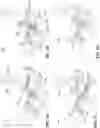 Fig. 03 - Dual screen electronic devices with stowable keyboards