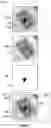 Fig. 06 - Image-based anomaly detection for aerial inspection using self-supervised learning