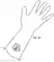 Fig. 19 - Cutaneous information devices and methods to manufacture the same