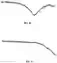 Fig. 15 - Systems and methods for detecting and grouping anomalies in data