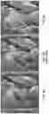 Fig. 06 - Bidirectional edge highlighting with strong edge attenuation
