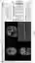 Fig. 15 - Systems and methods for image processing