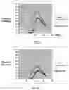 Fig. 06 - Stereoscopic image capture with performance outcome prediction in sporting environments