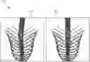 Fig. 01 - Systems and methods for automated distortion correction and/or co-registration of three-dimensional images using artificial landmarks along bones