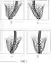 Fig. 02 - Systems and methods for automated distortion correction and/or co-registration of three-dimensional images using artificial landmarks along bones
