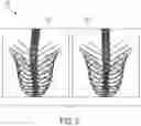 Fig. 03 - Systems and methods for automated distortion correction and/or co-registration of three-dimensional images using artificial landmarks along bones
