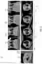 Fig. 04 - Systems and methods for automated distortion correction and/or co-registration of three-dimensional images using artificial landmarks along bones