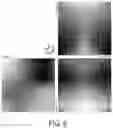 Fig. 07 - Systems and methods for automated distortion correction and/or co-registration of three-dimensional images using artificial landmarks along bones
