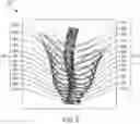 Fig. 09 - Systems and methods for automated distortion correction and/or co-registration of three-dimensional images using artificial landmarks along bones