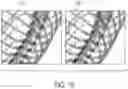 Fig. 13 - Systems and methods for automated distortion correction and/or co-registration of three-dimensional images using artificial landmarks along bones