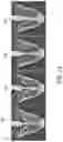 Fig. 20 - Systems and methods for automated distortion correction and/or co-registration of three-dimensional images using artificial landmarks along bones