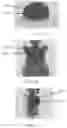 Fig. 15 - Systems and methods for correcting mismatch induced by respiratory motion in positron emission tomography image reconstruction