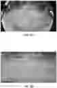 Fig. 09 - Surround view generation
