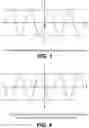 Fig. 03 - PANNING DISPLAYED INFORMATION TO COMPENSATE FOR PARKINSON'S DISEASE INDUCED MOTION OF ELECTRONIC DEVICES