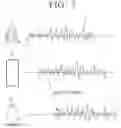 Fig. 07 - Electronic device and method for providing or obtaining data for training thereof