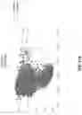 Fig. 13 - METHODS OF NORMALIZING AND CORRECTING RNA EXPRESSION DATA