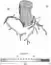 Fig. 01 - Methods and systems for predicting sensitivity of blood flow calculations to changes in anatomical geometry