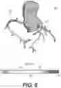 Fig. 07 - Methods and systems for predicting sensitivity of blood flow calculations to changes in anatomical geometry