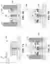 Fig. 02 - Hybrid under-bump metallization component