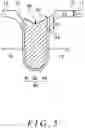 Fig. 06 - Method of manufacturing a semiconductor device including a shoulder portion