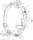 Fig. 02 - Guide ring for connection to a housing of an electric machine