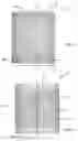 Fig. 05 - Method of manufacturing an induction rotor