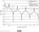 Fig. 10 - Multipath filters